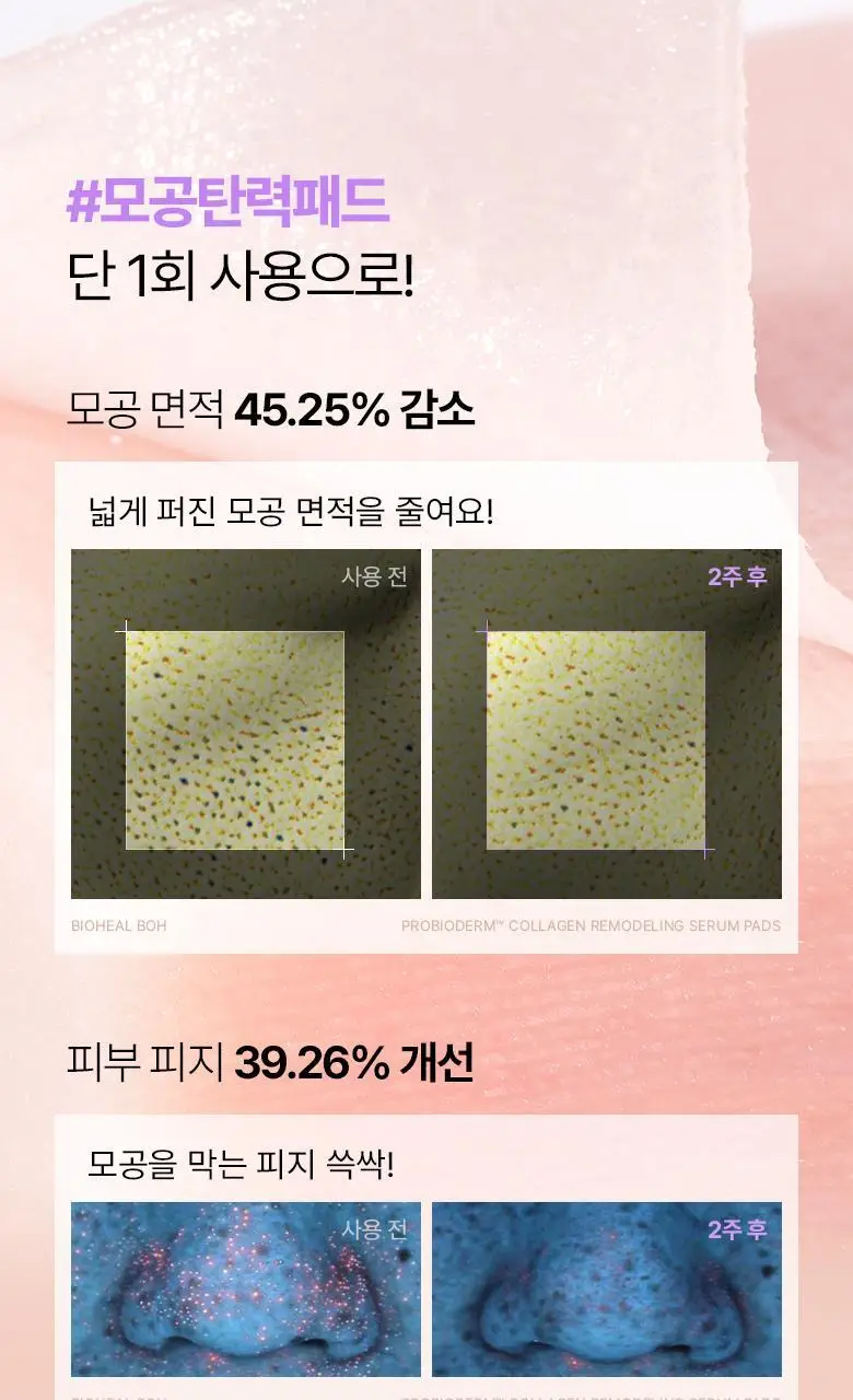 [모공고민|닦팩토듀얼] 바이오힐보 프로바이오덤 콜라겐 리모델링 세럼 패드 70매 상세페이지 5